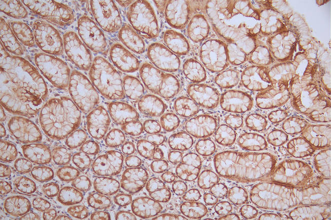 IHC image of MAPK1/MAPK3 Recombinant Monoclonal Antibody diluted at 1:50 and staining in paraffin-embedded human stomach tissue performed on a Leica BondTM system. After dewaxing and hydration, antigen retrieval was mediated by high pressure in a citrate buffer (pH 6.0). Section was blocked with 10% normal goat serum 30min at RT. Then primary antibody (1% BSA) was incubated at 4°C overnight. The primary is detected by a Goat anti-rabbit polymer IgG labeled by HRP and visualized using 0.64% DAB.MAPK1/MAPK3 Recombinant Monoclonal Antibody
