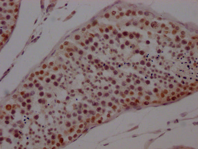 IHC image of PTBP1 Recombinant Monoclonal Antibody diluted at 1:100 and staining in paraffin-embedded human testis tissue performed on a Leica BondTM system. After dewaxing and hydration, antigen retrieval was mediated by high pressure in a citrate buffer (pH 6.0). Section was blocked with 10% normal goat serum 30min at RT. Then primary antibody (1% BSA) was incubated at 4℃ overnight. The primary is detected by a Goat anti-rabbit IgG polymer labeled by HRP and visualized using 0.05% DAB.PTBP1 Recombinant Monoclonal Antibody