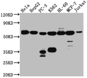 Western Blot | Positive WB detected in: Hela whole cell lysate, HepG2 whole cell lysate, PC-3 whole cell lysate, K562 whole cell lysate, HL-60 whole cell lysate, MCF-7 whole cell lysate, Jurkat whole cell lysate | All lanes: PTBP1 antibody at 1:1000 | Secondary | Goat polyclonal to rabbit IgG at 1/50000 dilution | Predicted band size: 58, 60, 60 kDa | Observed band size: 58 kDaPTBP1 Recombinant Monoclonal Antibody