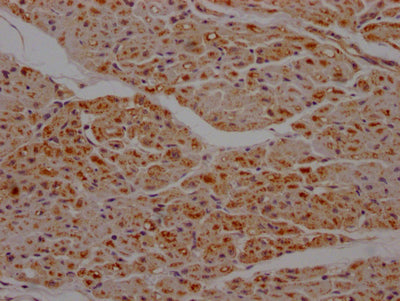 IHC image of SDHB Recombinant Monoclonal Antibody diluted at 1:100 and staining in paraffin-embedded human heart tissue performed on a Leica BondTM system. After dewaxing and hydration, antigen retrieval was mediated by high pressure in a citrate buffer (pH 6.0). Section was blocked with 10% normal goat serum 30min at RT. Then primary antibody (1% BSA) was incubated at 4℃ overnight. The primary is detected by a Goat anti-rabbit IgG polymer labeled by HRP and visualized using 0.05% DAB.SDHB Recombinant Monoclonal Antibody