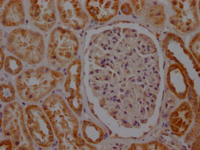 IHC image of SDHB Recombinant Monoclonal Antibody diluted at 1:100 and staining in paraffin-embedded human kidney tissue performed on a Leica BondTM system. After dewaxing and hydration, antigen retrieval was mediated by high pressure in a citrate buffer (pH 6.0). Section was blocked with 10% normal goat serum 30min at RT. Then primary antibody (1% BSA) was incubated at 4℃ overnight. The primary is detected by a Goat anti-rabbit IgG polymer labeled by HRP and visualized using 0.05% DAB.SDHB Recombinant Monoclonal Antibody