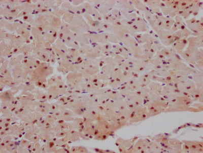 IHC image of MAPKAPK2 Recombinant Monoclonal Antibody diluted at 1:100 and staining in paraffin-embedded human heart tissue performed on a Leica BondTM system. After dewaxing and hydration, antigen retrieval was mediated by high pressure in a citrate buffer (pH 6.0). Section was blocked with 10% normal goat serum 30min at RT. Then primary antibody (1% BSA) was incubated at 4℃ overnight. The primary is detected by a Goat anti-rabbit IgG polymer labeled by HRP and visualized using 0.05% DAB.MAPKAPK2 Recombinant Monoclonal Antibody