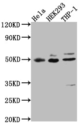 Western Blot | Positive WB detected in: Hela whole cell lysate, HEK293 whole cell lysate, THP-1 whole cell lysate | All lanes: MAPKAPK2 antibody at 1:1000 | Secondary | Goat polyclonal to rabbit IgG at 1/50000 dilution | Predicted band size: 46, 43 kDa | Observed band size: 49 kDaMAPKAPK2 Recombinant Monoclonal Antibody