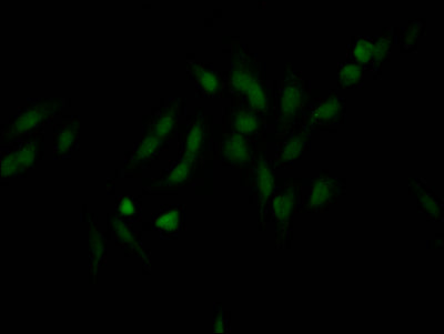 Immunofluorescence staining of Hela Cells with NUP98 Recombinant Monoclonal Antibody at 1:50, counter-stained with DAPI. The cells were fixed in 4% formaldehyde, permeated by 0.2% TritonX-100, and blocked in 10% normal Goat Serum. The cells were then incubated with the antibody overnight at 4℃. Nuclear DNA was labeled in blue with DAPI. The secondary antibody was FITC-conjugated AffiniPure Goat Anti-Rabbit IgG (H+L).NUP98 Recombinant Monoclonal Antibody
