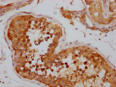 IHC image of NUP98 Recombinant Monoclonal Antibody diluted at 1:100 and staining in paraffin-embedded human testis tissue performed on a Leica BondTM system. After dewaxing and hydration, antigen retrieval was mediated by high pressure in a citrate buffer (pH 6.0). Section was blocked with 10% normal goat serum 30min at RT. Then primary antibody (1% BSA) was incubated at 4℃ overnight. The primary is detected by a Goat anti-rabbit IgG polymer labeled by HRP and visualized using 0.05% DAB.NUP98 Recombinant Monoclonal Antibody