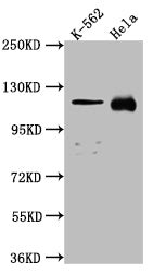 Western Blot | Positive WB detected in: K562 whole cell lysate, Hela whole cell lysate | All lanes: NUP98 antibody at 1:1000 | Secondary | Goat polyclonal to rabbit IgG at 1/50000 dilution | Predicted band size: 198, 188, 98, 97, 196, 187 kDa | Observed band size: 100 kDaNUP98 Recombinant Monoclonal Antibody