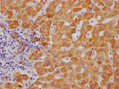 IHC image of MAOB Recombinant Monoclonal Antibody diluted at 1:100 and staining in paraffin-embedded human liver tissue performed on a Leica BondTM system. After dewaxing and hydration, antigen retrieval was mediated by high pressure in a citrate buffer (pH 6.0). Section was blocked with 10% normal goat serum 30min at RT. Then primary antibody (1% BSA) was incubated at 4℃ overnight. The primary is detected by a Goat anti-rabbit IgG polymer labeled by HRP and visualized using 0.05% DAB.MAOB Recombinant Monoclonal Antibody