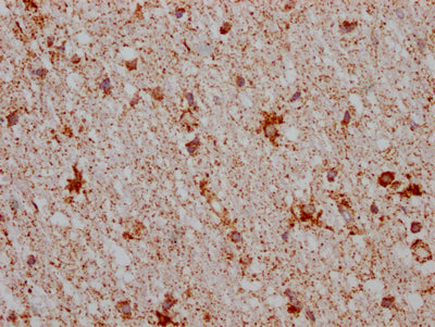 IHC image of MAOB Recombinant Monoclonal Antibody diluted at 1:100 and staining in paraffin-embedded human brain tissue performed on a Leica BondTM system. After dewaxing and hydration, antigen retrieval was mediated by high pressure in a citrate buffer (pH 6.0). Section was blocked with 10% normal goat serum 30min at RT. Then primary antibody (1% BSA) was incubated at 4℃ overnight. The primary is detected by a Goat anti-rabbit IgG polymer labeled by HRP and visualized using 0.05% DAB.MAOB Recombinant Monoclonal Antibody