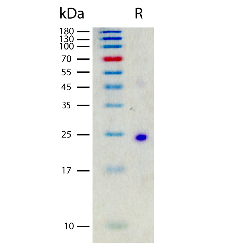 Recombinant Mouse IL-6 Protein | Beta LifeScience