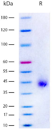 Recombinant Human Soluble DLK-1 (sDLK-1) Protein | Beta LifeScience
