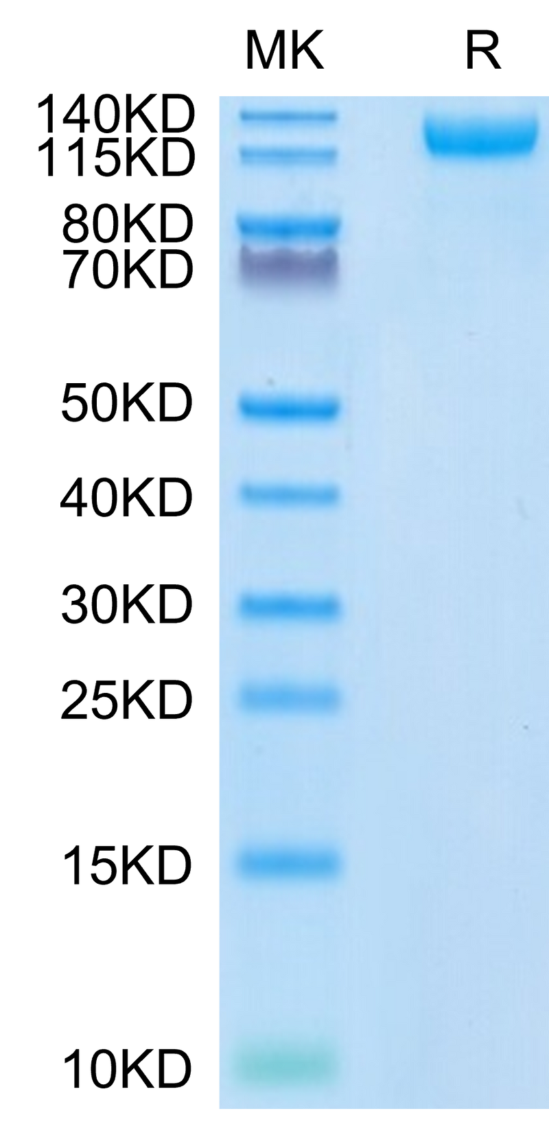 SARS-COV-2 Spike S1 (N501Y) on Tris-Bis PAGE under reduced condition. The purity is greater than 95%.Recombinant SARS-COV-2 Spike S1 (N501Y) Protein, Active