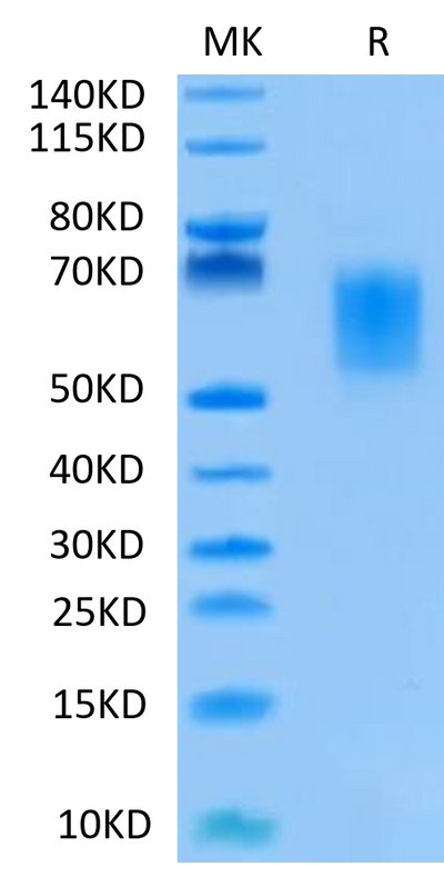Human B7-H2 on Tris-Bis PAGE under reduced condition. The purity is greater than 95%.Recombinant Human B7-H2/ICOSLG Protein, Active