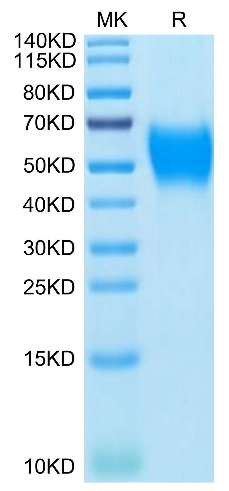 Mouse B7-H2 on Tris-Bis PAGE under reduced condition. The purity is greater than 95%.Recombinant Mouse B7-H2/ICOSLG Protein, Active