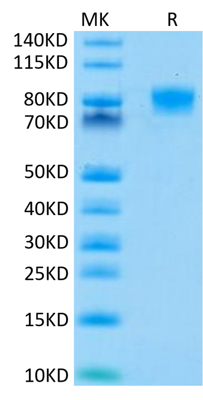 Human B7-H2 on Tris-Bis PAGE under reduced condition. The purity is greater than 95%.Recombinant Human B7-H2/ICOSLG Protein, Active