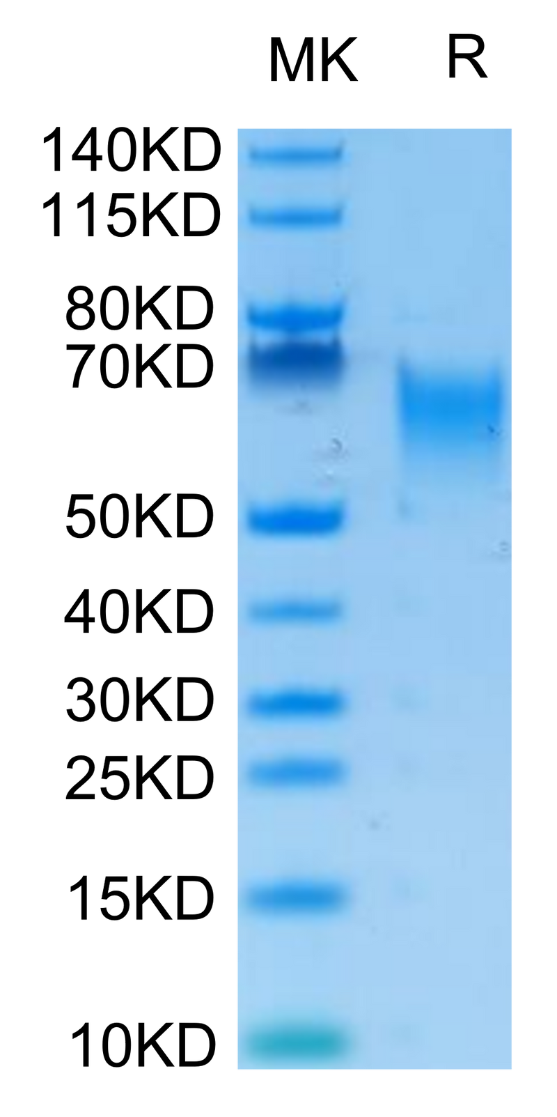 Biotinylated Human B7-H2 on Tris-Bis PAGE under reduced condition. The purity is greater than 95%.Biotinylated Human B7-H2/ICOSLG Protein, Active