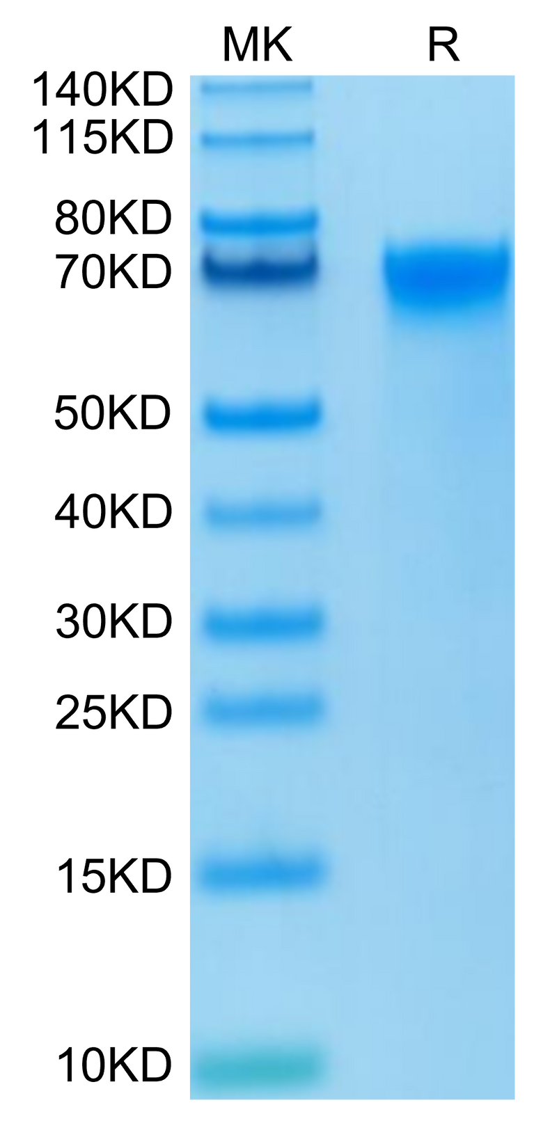 Biotinylated Human LILRB3 on Tris-Bis PAGE under reduced condition. The purity is greater than 95%.Biotinylated Human LILRB3/CD85a/ILT5 Protein, Active
