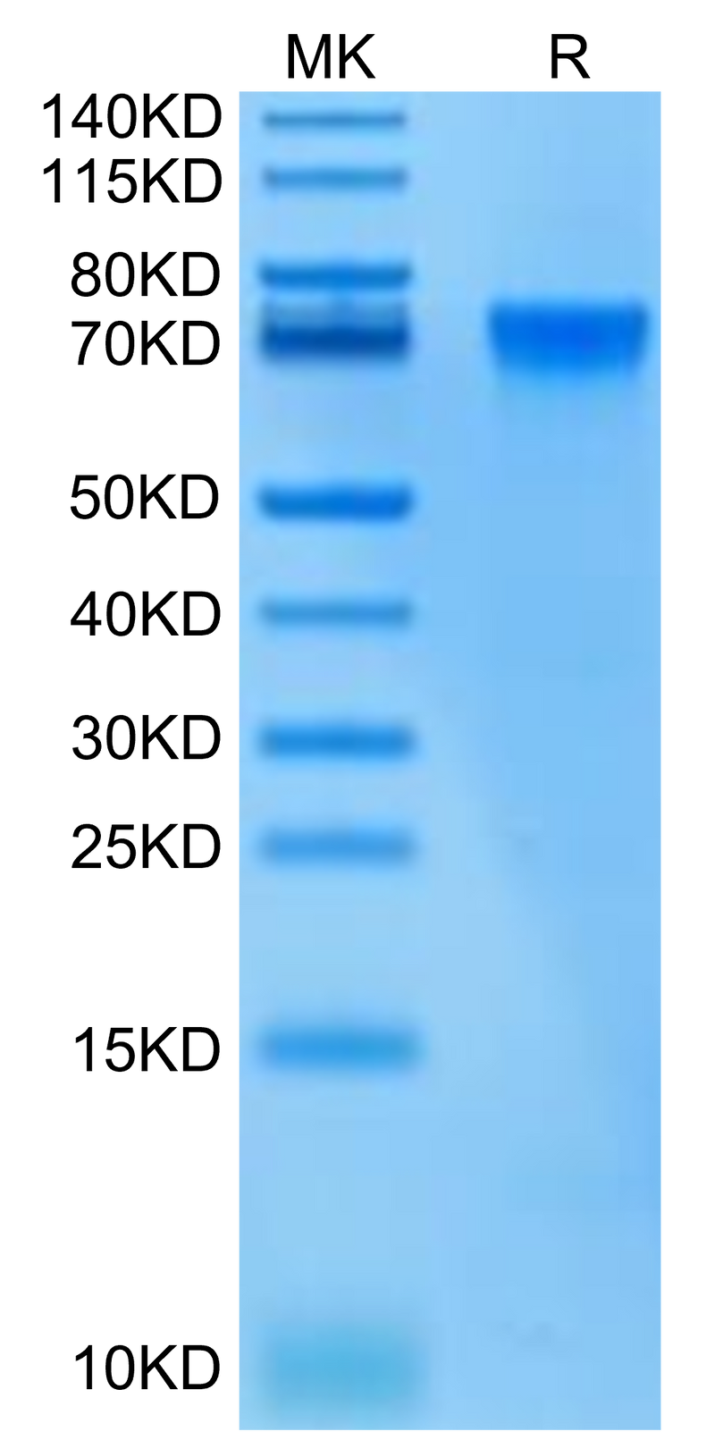 Biotinylated Human LILRB2 on Tris-Bis PAGE under reduced condition. The purity is greater than 95%.Biotinylated Human LILRB2/CD85d/ILT4 Protein, Active