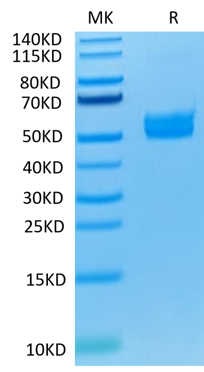 Human ICOS on Tris-Bis PAGE under reduced condition. The purity is greater than 95%.Recombinant Human ICOS/CD278 Protein, Active