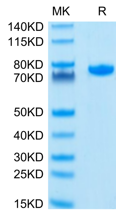 Human Nectin-2 on Tris-Bis PAGE under reduced condition. The purity is greater than 95%.Recombinant Human Nectin-2/CD112 Protein, Active