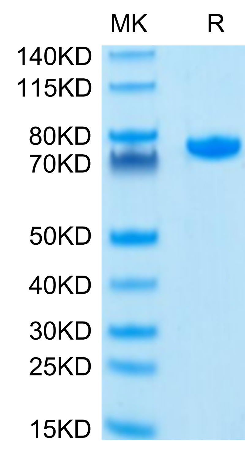 Human Nectin-2 on Tris-Bis PAGE under reduced condition. The purity is greater than 95%.Recombinant Human Nectin-2/CD112 Protein, Active