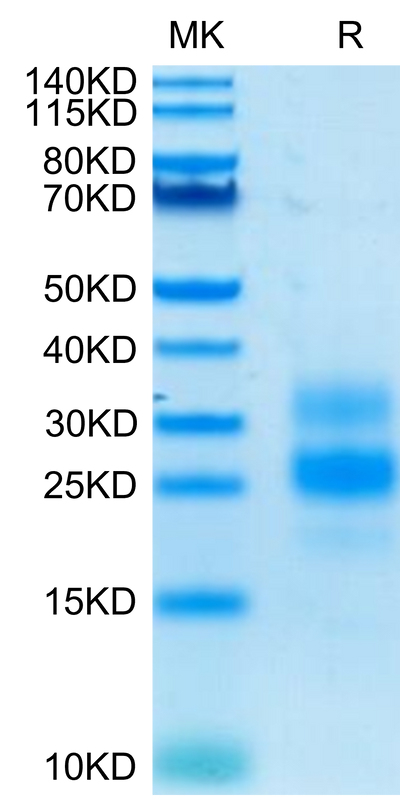 Human ICOS on Tris-Bis PAGE under reduced condition. The purity is greater than 90%.Recombinant Human ICOS/CD278 Protein, Active