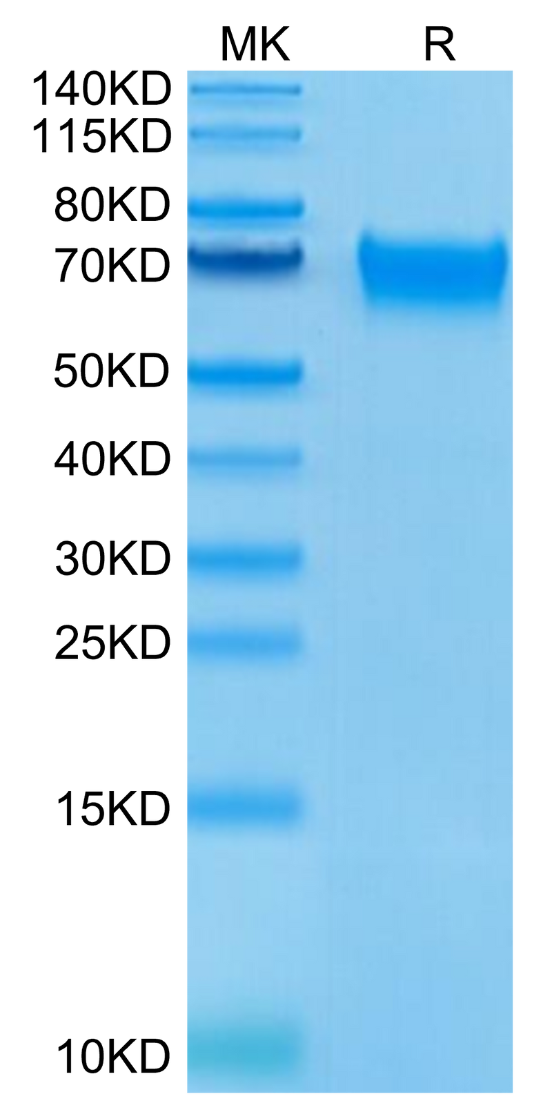Human LILRB3 on Tris-Bis PAGE under reduced condition. The purity is greater than 95%.Recombinant Human LILRB3/CD85a/ILT5 Protein, Active