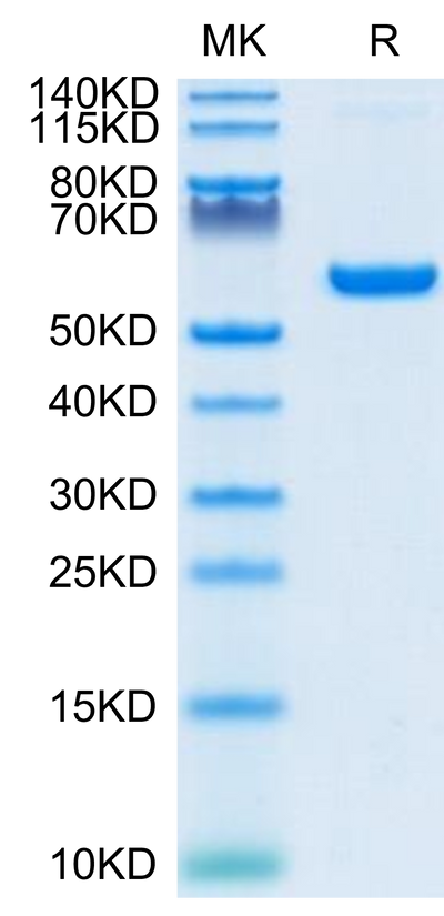 SARS-COV-2 Spike RBD on Tris-Bis PAGE under reduced condition. The purity is greater than 95%.Recombinant SARS-COV-2 Spike RBD Protein, Active