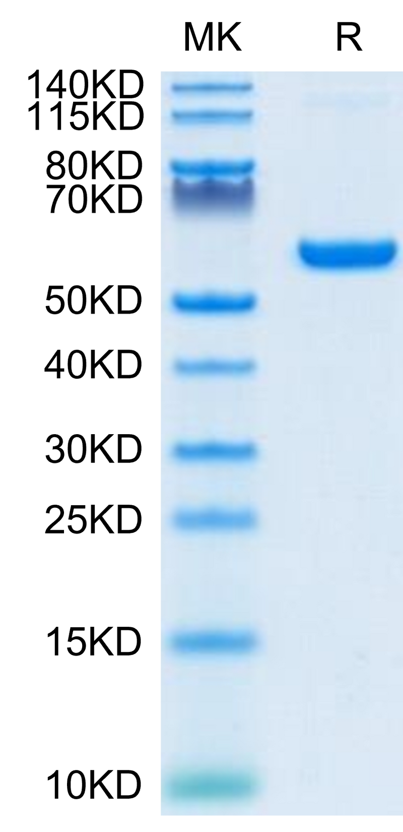 SARS-COV-2 Spike RBD on Tris-Bis PAGE under reduced condition. The purity is greater than 95%.Recombinant SARS-COV-2 Spike RBD Protein, Active