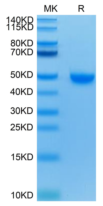 Human Nectin-2 on Tris-Bis PAGE under reduced condition. The purity is greater than 95%.Recombinant Human Nectin-2/CD112 Protein, Active