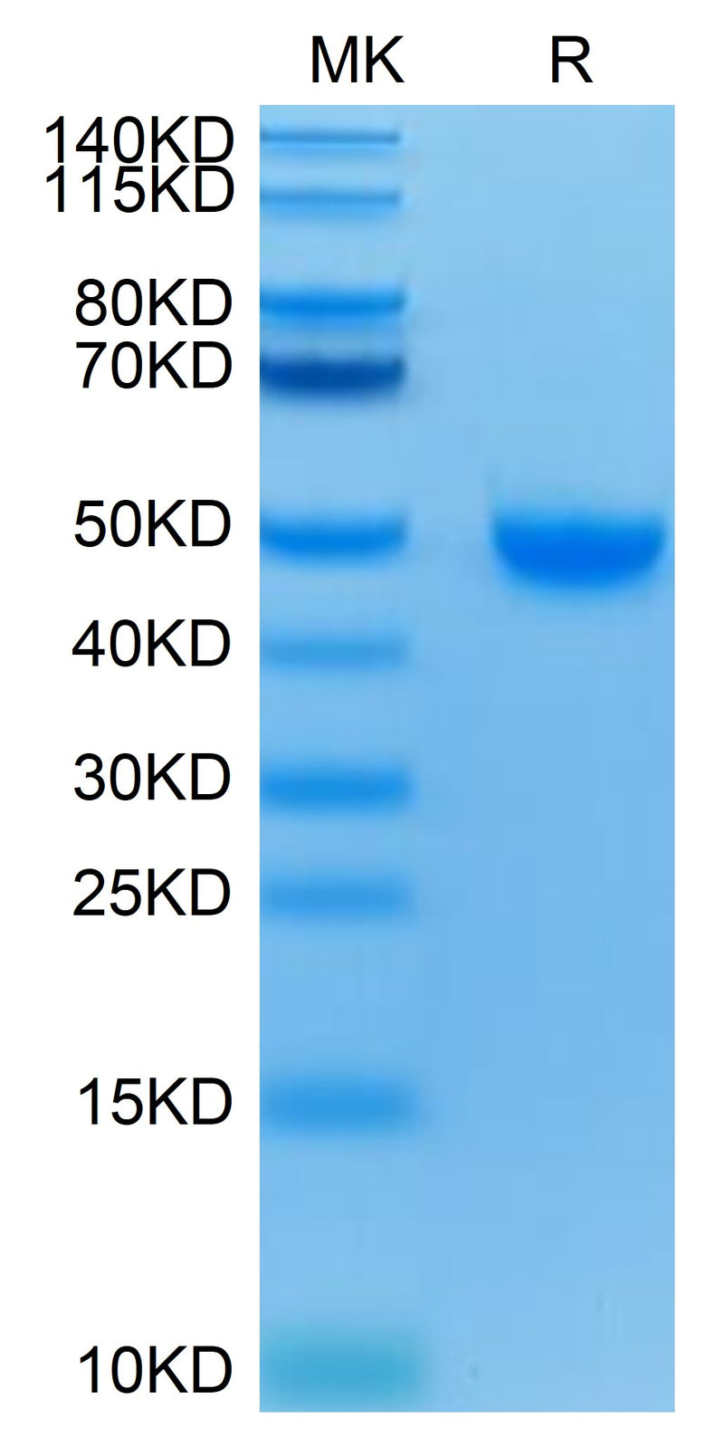 Human Nectin-2 on Tris-Bis PAGE under reduced condition. The purity is greater than 95%.Recombinant Human Nectin-2/CD112 Protein, Active