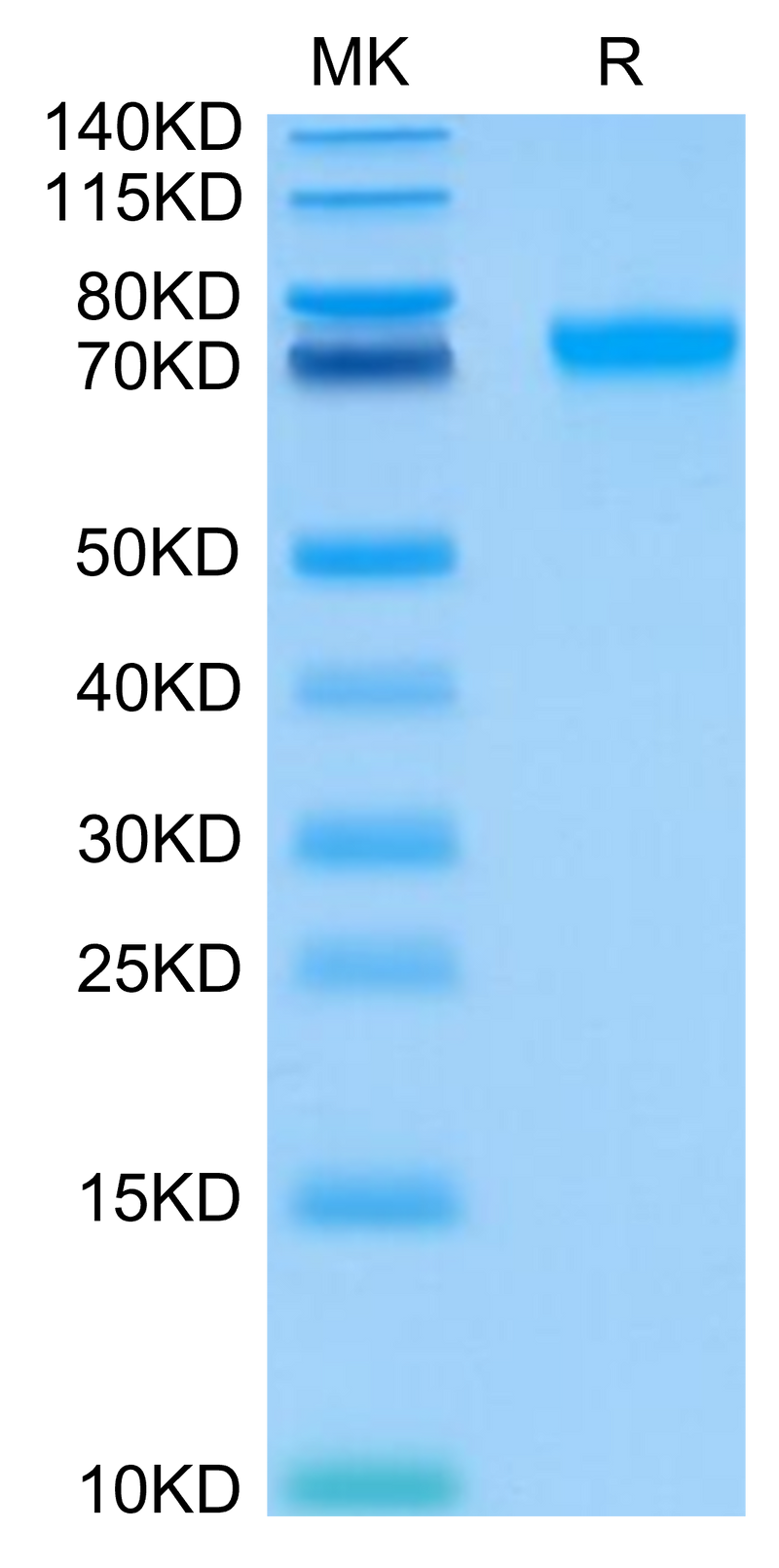 Human LILRB2 on Tris-Bis PAGE under reduced condition. The purity is greater than 95%.Recombinant Human LILRB2/CD85d/ILT4 Protein, Active