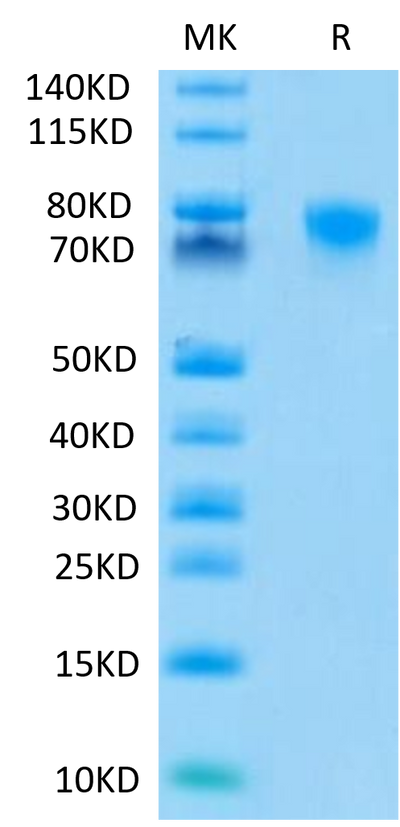Human TNFR2-on Tris-Bis PAGE under reduced conditions. The purity is greater than 95%.Recombinant Human TNFR2/CD120b/TNFRSF1B Protein, Active