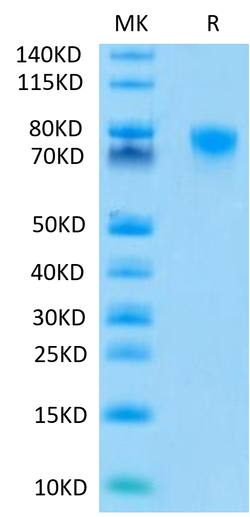 Human TNFR2-on Tris-Bis PAGE under reduced conditions. The purity is greater than 95%.Recombinant Human TNFR2/CD120b/TNFRSF1B Protein, Active