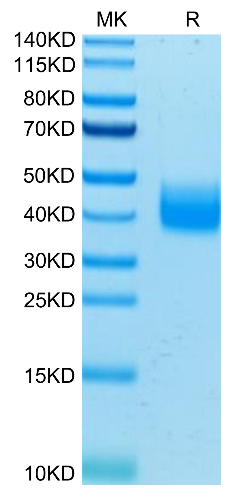 Human LILRA5 on Tris-Bis PAGE under reduced condition. The purity is greater than 95%.