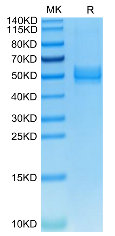 Mouse ICOS on Tris-Bis PAGE under reduced condition. The purity is greater than 95%.Recombinant Mouse ICOS/CD278 Protein, Active