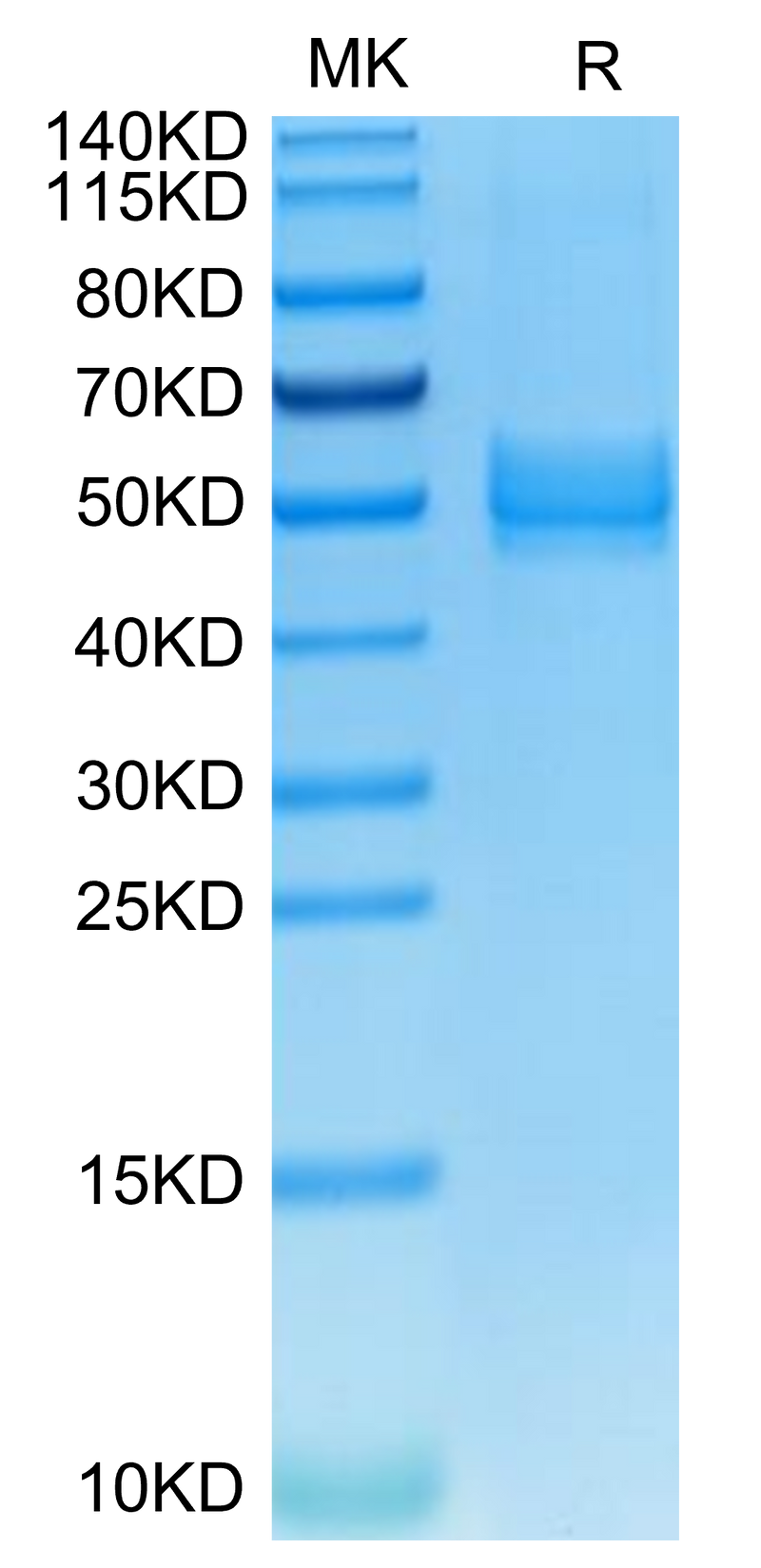 Mouse ICOS on Tris-Bis PAGE under reduced condition. The purity is greater than 95%.Recombinant Mouse ICOS/CD278 Protein, Active