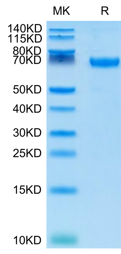 Cynomolgus PD-L1 on Tris-Bis PAGE under reduced conditions. The purity is greater than 95%.Recombinant Cynomolgus PD-L1/B7-H1 Protein, Active