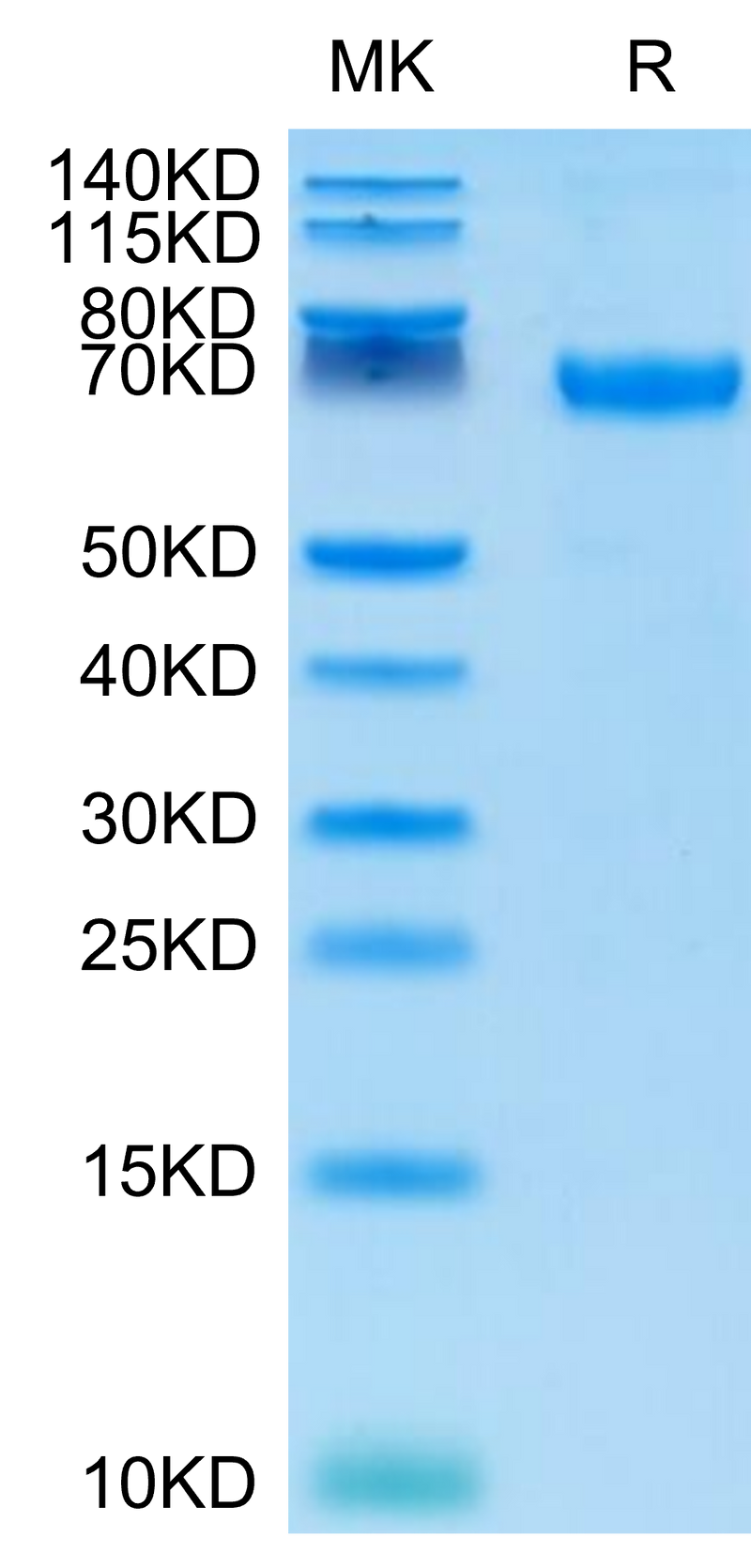 Cynomolgus PD-L1 on Tris-Bis PAGE under reduced conditions. The purity is greater than 95%.Recombinant Cynomolgus PD-L1/B7-H1 Protein, Active