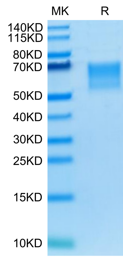 Human TPBG on Tris-Bis PAGE under reduced condition. The purity is greater than 95%.Recombinant Human TPBG/5T4 Protein, Active