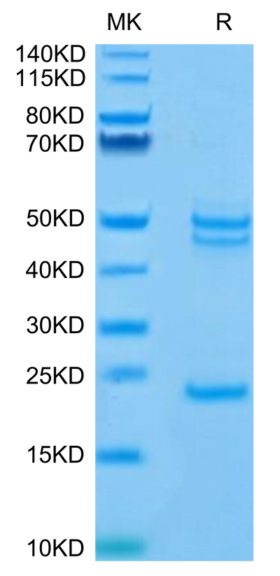 Mouse IL-23 alpha&IL-12 beta on Tris-Bis PAGE under reduced condition. The purity is greater than 95%.Recombinant Mouse IL-23 alpha&IL-12 beta Protein, Active