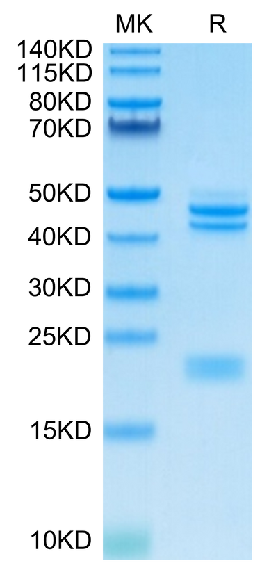 Cynomolgus IL-23 alpha&Mouse IL-12 beta on Tris-Bis PAGE under reduced condition. The purity is greater than 95%.Recombinant Cynomolgus IL-23 alpha&Mouse IL-12 beta Protein, Active
