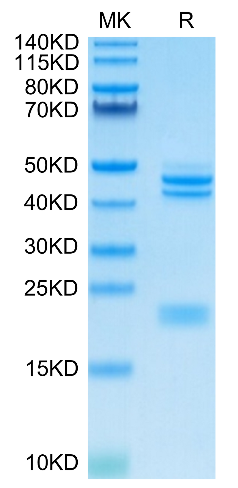 Cynomolgus IL-23 alpha&Mouse IL-12 beta on Tris-Bis PAGE under reduced condition. The purity is greater than 95%.Recombinant Cynomolgus IL-23 alpha&Mouse IL-12 beta Protein, Active