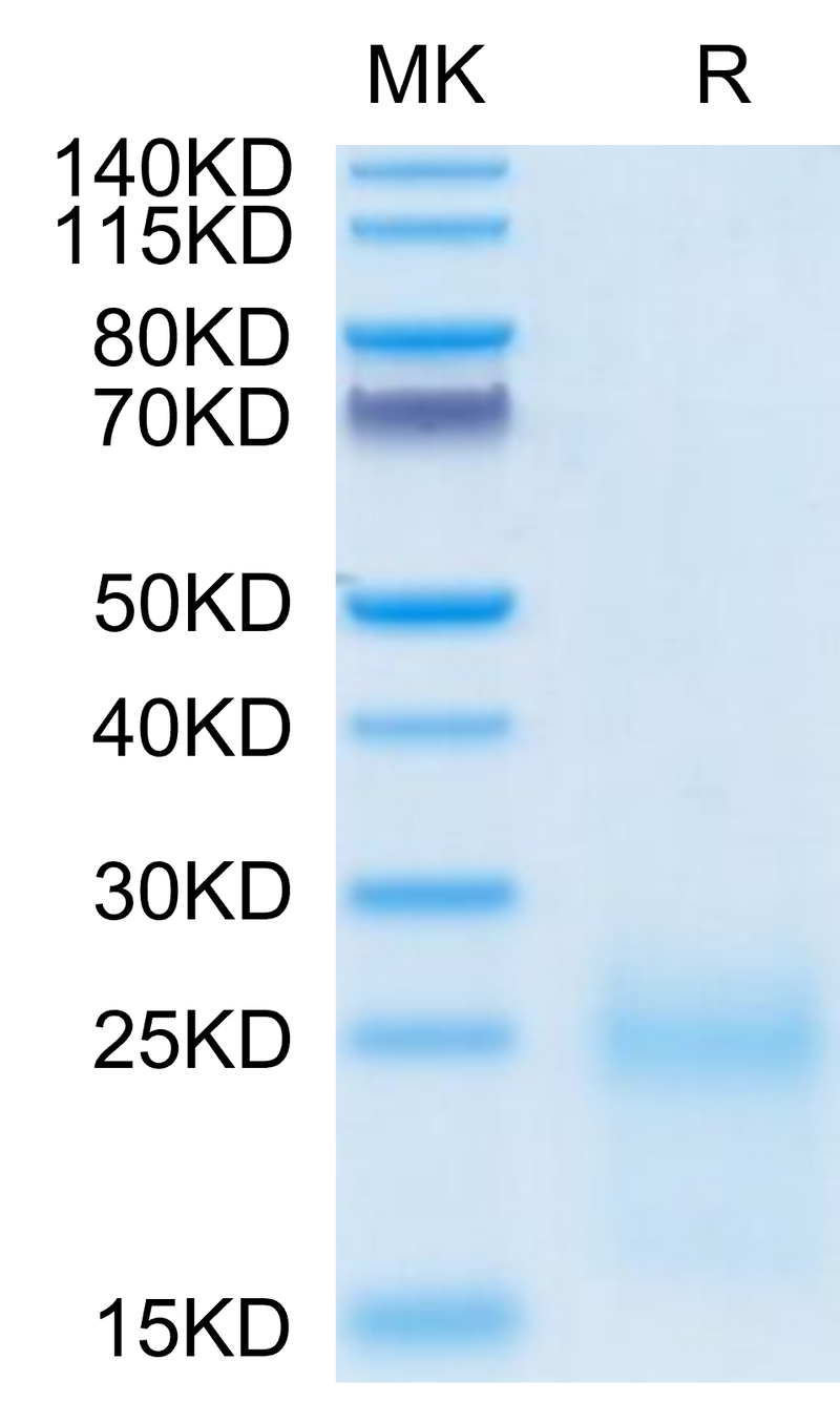 Cynomolgus TSLP on Tris-Bis PAGE under reduced condition. The purity is greater than 95%.Recombinant Cynomolgus TSLP Protein, Active