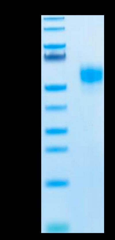 Human SIRP alpha V5 on Tris-Bis PAGE under reduced condition. The purity is greater than 95%.Recombinant Human SIRP alpha V5 Protein, Active
