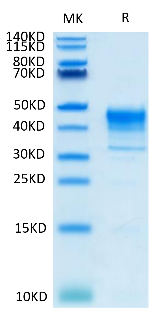 Biotinylated Cynomolgus MSLN on Tris-Bis PAGE under reduced condition. The purity is greater than 95%.Biotinylated Cynomolgus MSLN/Mesothelin Protein (Primary Amine Labeling), Active