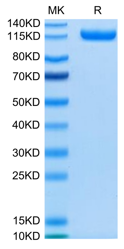 Human CDCP1 on Tris-Bis PAGE under reduced condition. The purity is greater than 95%.Recombinant Human CDCP1 Protein, Active