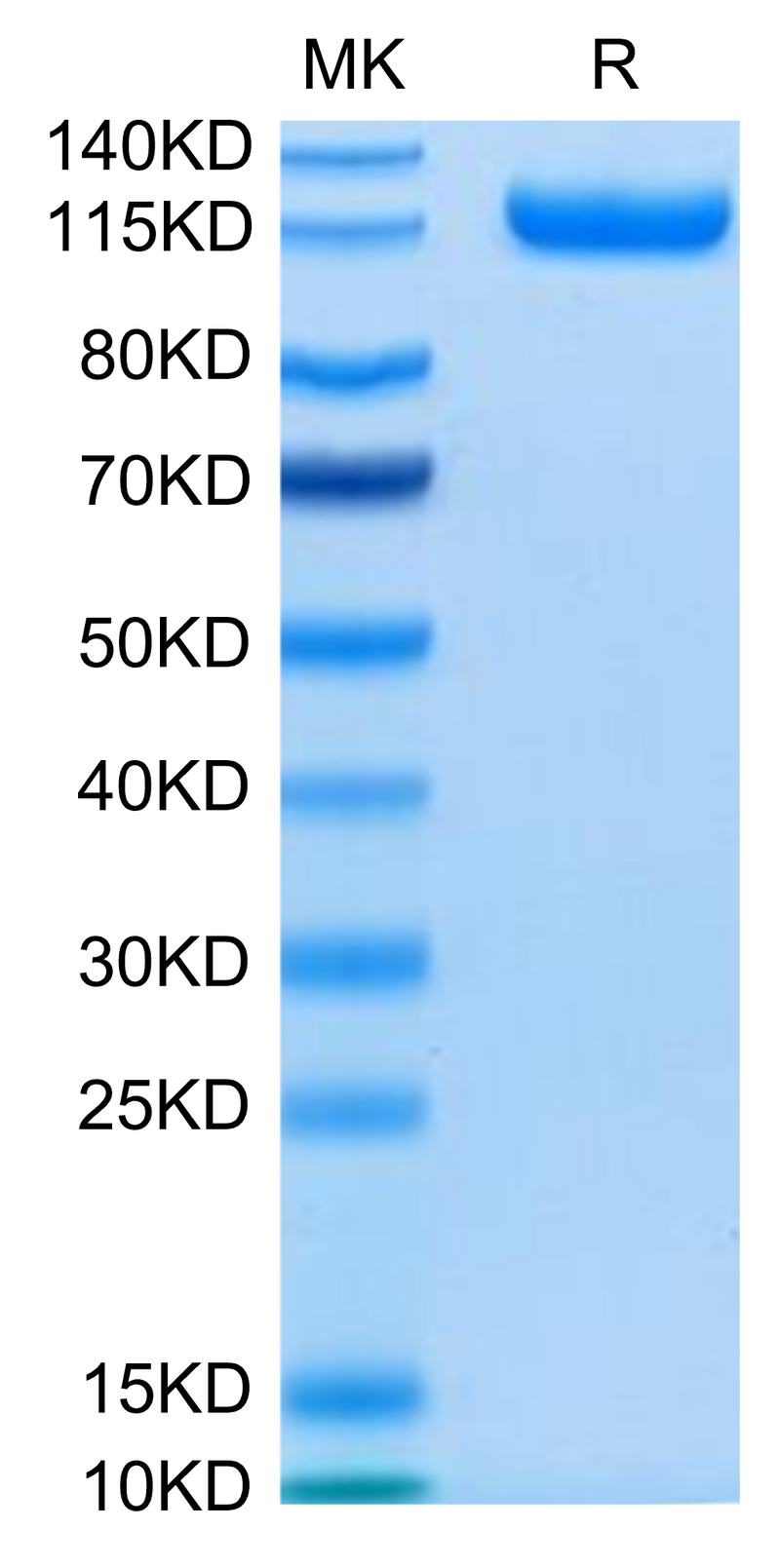 Human CDCP1 on Tris-Bis PAGE under reduced condition. The purity is greater than 95%.Recombinant Human CDCP1 Protein, Active