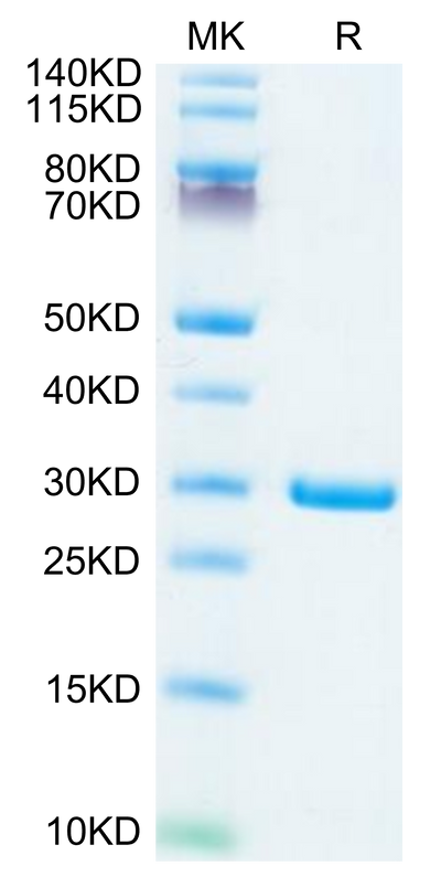 SARS-COV-2 NSP7&NSP8 on Tris-Bis PAGE under reduced condition. The purity is greater than 95%.Recombinant SARS-COV-2 NSP7&NSP8 Protein
