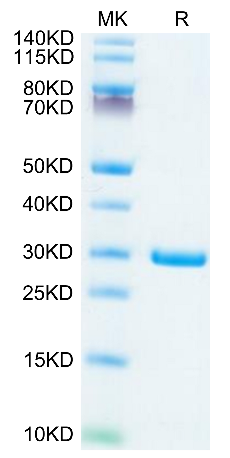 SARS-COV-2 NSP7&NSP8 on Tris-Bis PAGE under reduced condition. The purity is greater than 95%.Recombinant SARS-COV-2 NSP7&NSP8 Protein