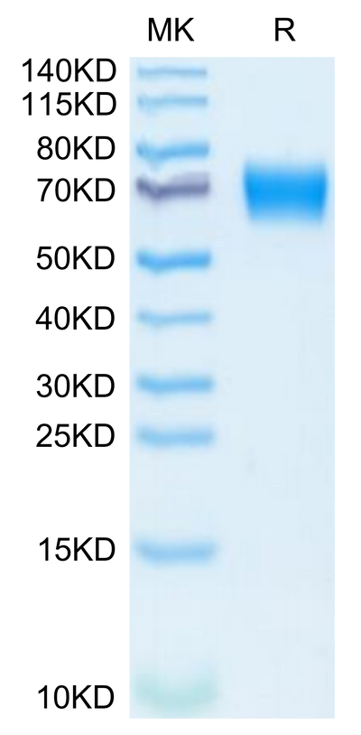 Mouse IL-18 R1 on Tris-Bis PAGE under reduced condition. The purity is greater than 95%.Recombinant Mouse IL-18 R1/CD218a Protein, Active